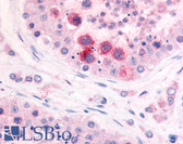 Anti-PDE3A Antibody (N-Terminus) IHC-plus LS-A732