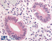 Anti-PDE3A Antibody (Internal) IHC-plus LS-A749