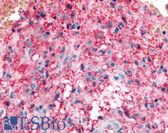 Anti-KCNMB3 Antibody (C-Terminus) IHC-plus LS-A8112