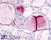 Anti-PDE8B Antibody (Internal) IHC-plus LS-A710