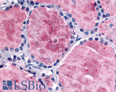 Anti-PDE8B Antibody (Internal) IHC-plus LS-A711