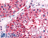 Anti-UCHL3 Antibody (Internal) IHC-plus LS-A8555