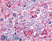 Anti-SLC5A3 / SMIT2 Antibody (Internal) IHC-plus LS-A2757