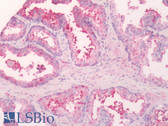 Anti-SLC5A3 / SMIT2 Antibody (Internal) IHC-plus LS-A2761