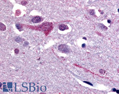 Anti-SLC5A9 / SGLT4 Antibody (C-Terminus) IHC-plus LS-A2787