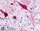 Anti-SLC5A9 / SGLT4 Antibody (C-Terminus) IHC-plus LS-A2788