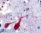 Anti-SLC5A9 / SGLT4 Antibody (Cytoplasmic Domain) IHC-plus LS-A2920