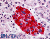 Anti-GPR55 Antibody (Cytoplasmic Domain) IHC-plus LS-A162