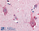 Anti-NTRK2 / TRKB Antibody (Cytoplasmic Domain) IHC-plus LS-A9401