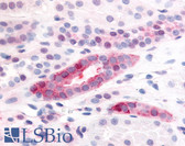 Anti-PDGFRB / PDGFR Beta Antibody (Extracellular Domain) IHC-plus LS-A9413