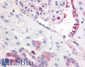 Anti-PDGFRB / PDGFR Beta Antibody (Extracellular Domain) IHC-plus LS-A9414