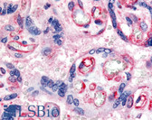 Anti-FLT1 / VEGFR1 Antibody (C-Terminus) IHC-plus LS-A9440