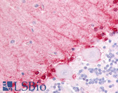 Anti-ADGRB3 Antibody (N-Terminus) IHC-plus LS-A3583