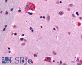 Anti-CNR1 / CB1 Antibody (N-Terminus) IHC-plus LS-A4039