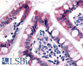 Anti-ESRRG / ERR Gamma Antibody (N-Terminus) IHC-plus LS-A6487