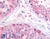 Anti-GPR22 Antibody (Cytoplasmic Domain) IHC-plus LS-A5149