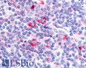 Anti-GPRC5D Antibody (Cytoplasmic Domain) IHC-plus LS-A4180