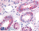 Anti-GPR1 Antibody (Cytoplasmic Domain) IHC-plus LS-A4234