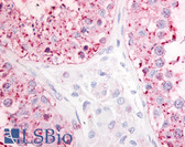 Anti-GPR68 / OGR1 Antibody (Cytoplasmic Domain) IHC-plus LS-A3970