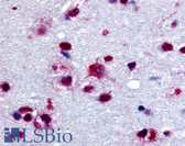 Anti-GPBB / PYGB Antibody (C-Terminus) IHC-plus LS-A1489