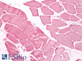 Anti-UCHL3 Antibody (Internal) IHC-plus LS-A8557
