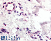 Anti-CCR10 / GPR2 Antibody (N-Terminus) IHC-plus LS-A1153