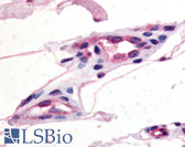 Anti-CCR10 / GPR2 Antibody (C-Terminus) IHC-plus LS-A1154