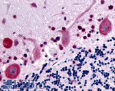 Anti-GPR32 Antibody (Cytoplasmic Domain) IHC-plus LS-A1679