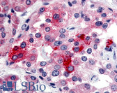 Anti-BRS3 Antibody (Extracellular Domain) IHC-plus LS-A22