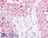Anti-GPR68 / OGR1 Antibody (N-Terminus) IHC-plus LS-A3968