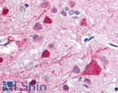 Anti-GPR52 Antibody (Cytoplasmic Domain) IHC-plus LS-A444