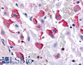 Anti-BRS3 Antibody (Cytoplasmic Domain) IHC-plus LS-A4916