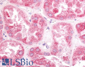 Anti-ESRRG / ERR Gamma Antibody (N-Terminus) IHC-plus LS-A5841