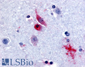 Anti-GPR61 Antibody (Extracellular Domain) IHC-plus LS-A6708
