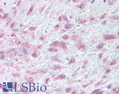 Anti-MMP9 / Gelatinase B Antibody (Internal) IHC-plus LS-A9461