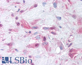 Anti-MMP9 / Gelatinase B Antibody (Internal) IHC-plus LS-A9463