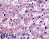 Anti-DPP9 Antibody (Internal) IHC-plus LS-A8308