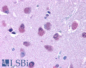 Anti-BRS3 Antibody (Cytoplasmic Domain) IHC-plus LS-A23