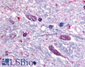Anti-SLC5A3 / SMIT2 Antibody (C-Terminus) IHC-plus LS-A2816