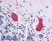 Anti-MARK1 / MARK Antibody (Internal) IHC-plus LS-A9500