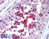 Anti-RNF216 / TRIAD3 Antibody (N-Terminus) IHC-plus LS-B1430