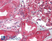 Anti-XBP1 Antibody (C-Terminus) IHC-plus LS-B1437