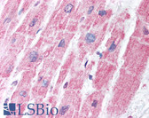 Anti-MDH1 Antibody IHC-plus LS-B1446