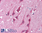 Anti-MRE11A / MRE11 Antibody (aa68-706) IHC-plus LS-B1447