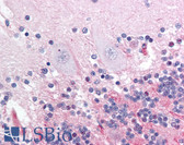 Anti-APP / Beta Amyloid Precursor Antibody (Thr668) IHC-plus LS-B1462