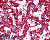 Anti-EIF2S1 Antibody (Ser51) IHC-plus LS-B1469