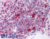 Anti-HSP90AB1 / HSP90 Alpha B1 Antibody (Ser254) IHC-plus LS-B1478