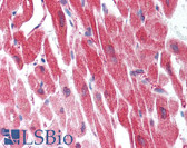 Anti-MLC2 / MYL9 Antibody (Ser18) IHC-plus LS-B1481