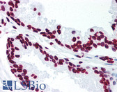 Anti-p66 / SHC Antibody (Tyr349) IHC-plus LS-B1489