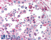 Anti-NBN / Nibrin Antibody (C-Terminus) IHC-plus LS-B1494